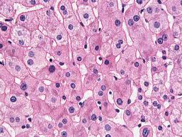 Hematoxylin and Eosin Stain