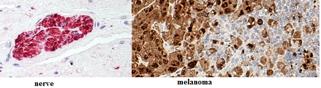 Automated IHC Staining