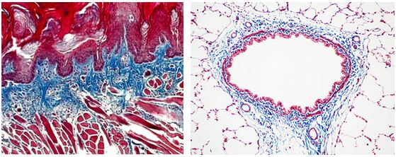 Hematoxylin and Eosin Stain