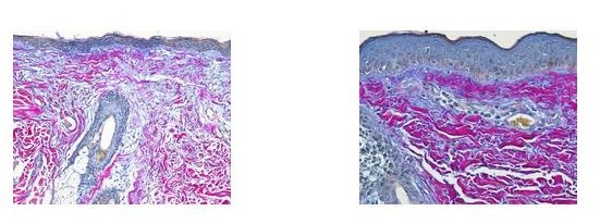 Hematoxylin and Eosin Stain