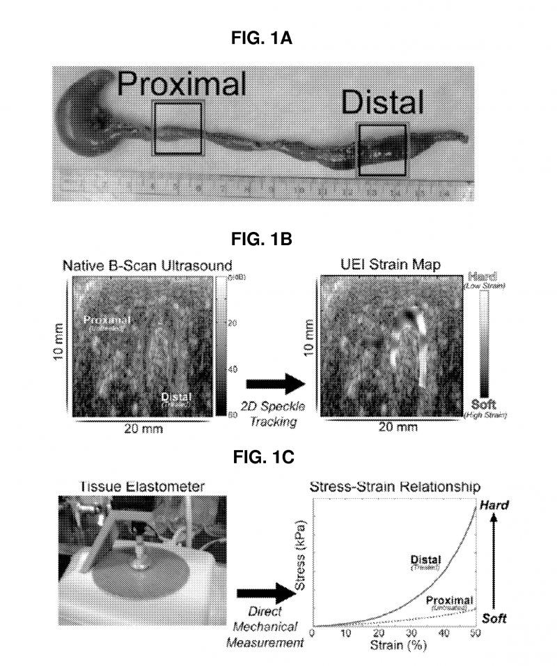 Methods And Apparatuses For Measuring Tissue Stiffness Changes Using ...