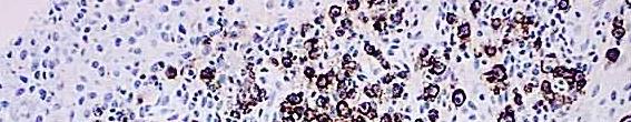 Tunel stain