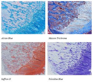 Examples of Bone Staining