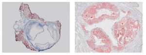 Mouse aortic root valve stained with Masson's Trichrome (left) and Oil Red O (right)