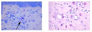 Example of Toluidine blue Staining