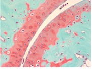 Example of Safranin O Staining