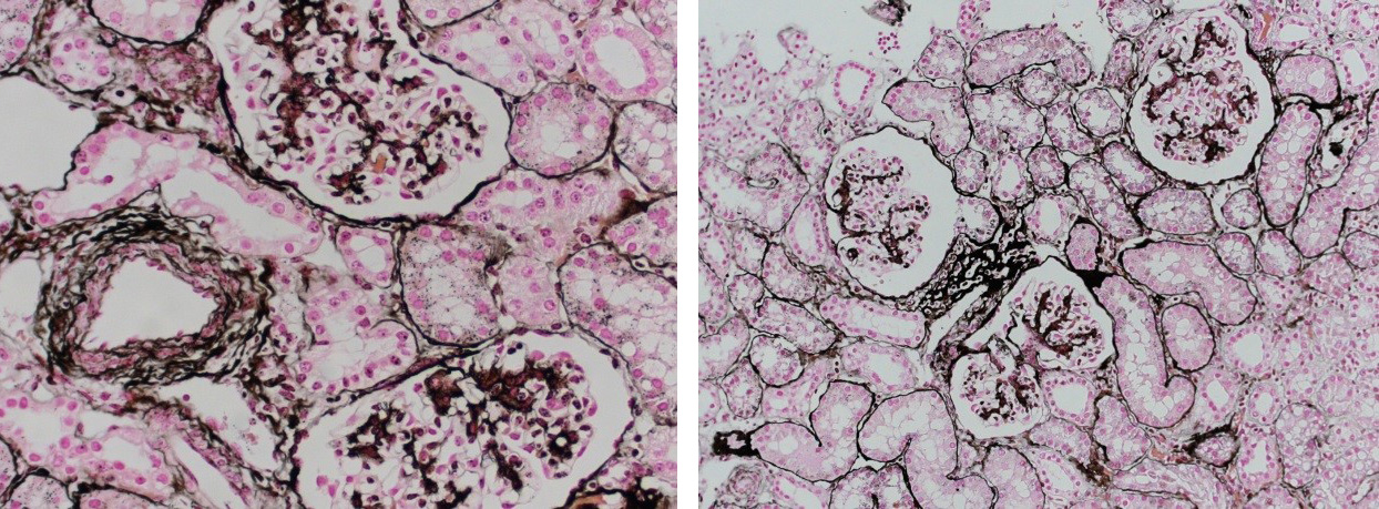 Jones Silver Stain is used to identify basement membrane and reticulin.