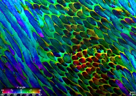 pic mapping tooth enamel