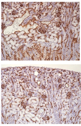 roy lab kidney