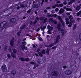 cmu placenta