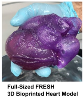 feinberg bioprinted heart model