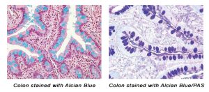 Examples of Alcian Blue and PAS Staining