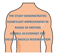 Volumetric Muscle Loss Study Illustration