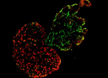 heart-lung development