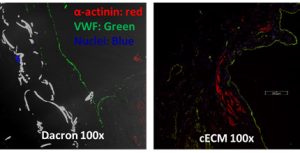 Immunofluorescent staining of a Dacron and cECM right ventricle explant. 