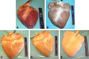 Representative images of the gross appearance of intact porcine hearts subjected to decellularization by retrograde perfusion.